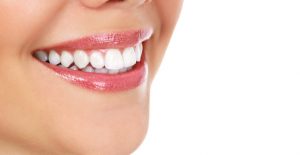 tooth whitening