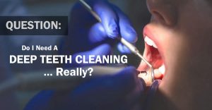 Patient Getting a Teeth Cleaning
