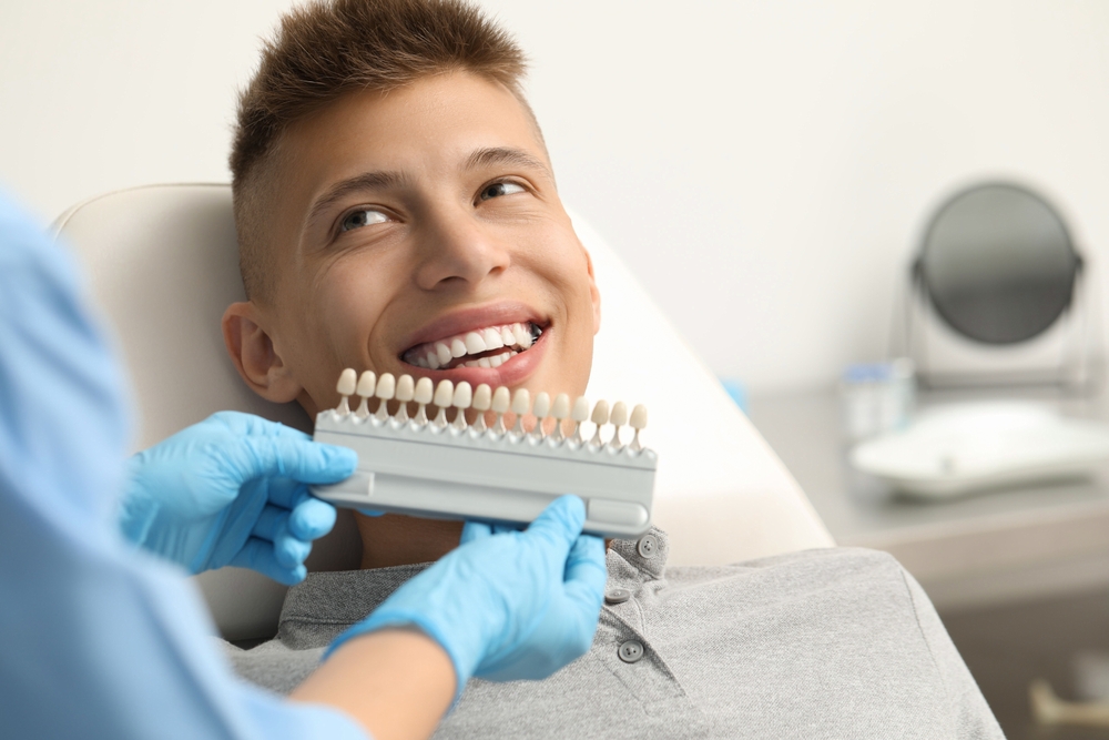 Veneers