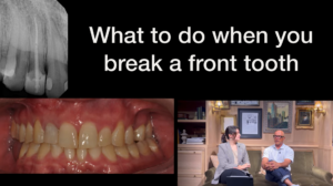 Saving a broken front tooth with Larry Saylor Dentistry in Brandon, FL.