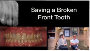 Saving a broken front tooth with Larry Saylor Dentistry in Brandon, FL.